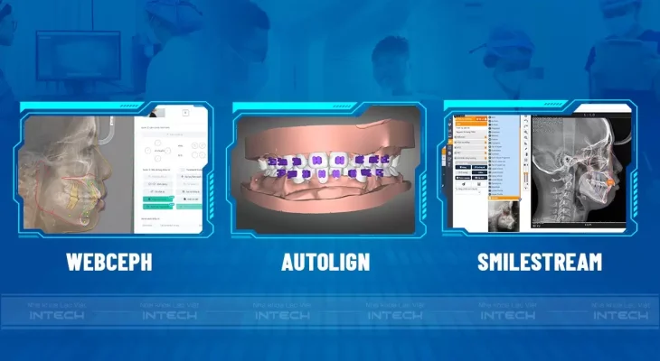 Giải Pháp Niềng Răng X-Matrix 2 2 1673490825 478 width1204height660
