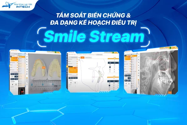 Giải Pháp Niềng Răng X-Matrix 4 450377917 500988435618542 456924934469845165 n
