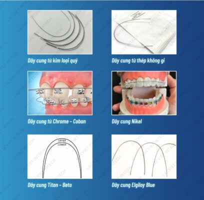 Các loại dây cung niềng răng phổ biến hiện nay Các loại dây cung niềng răng phổ biến hiện nay