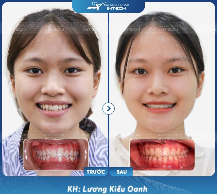 khach hang luong kieu oanh