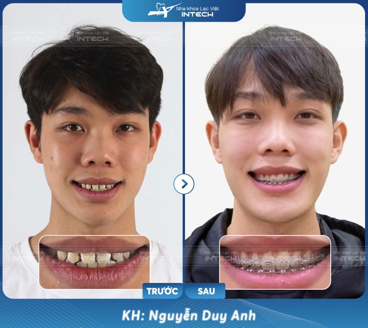 khach hang nguyen duy anh