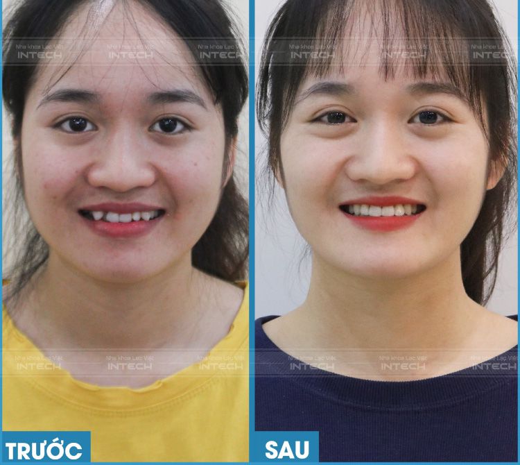 khach hang nguyen thi hau