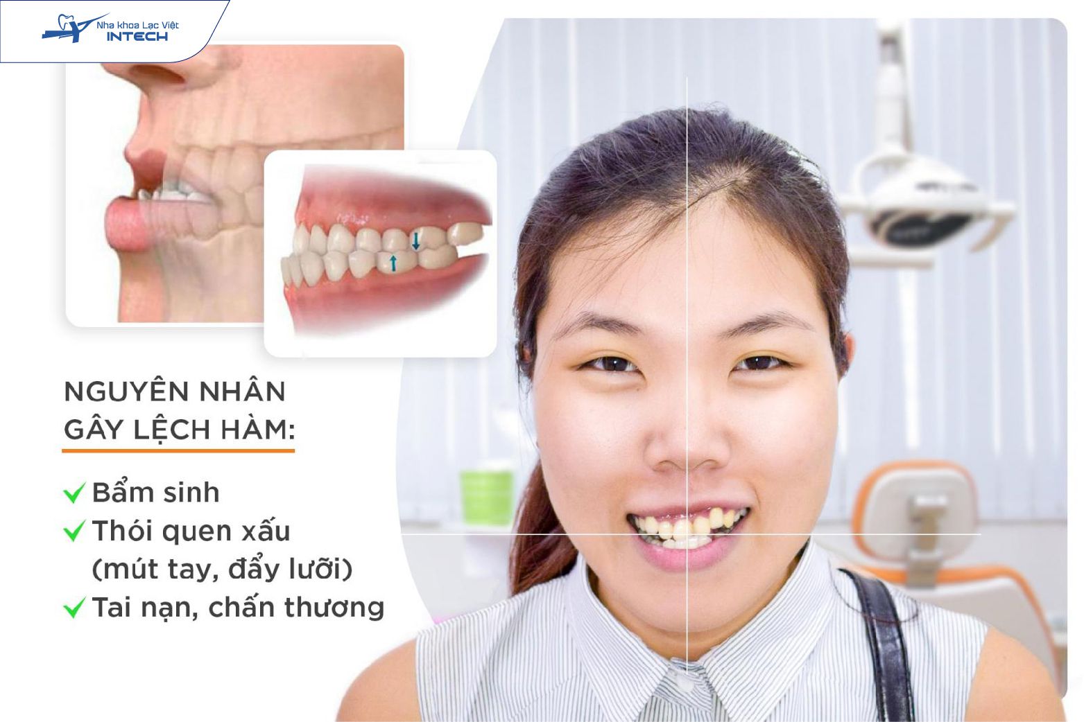 Khi điều trị niềng răng cần chuẩn bị trang thiết bị đầy đủ tránh gây lạc nhân Khi điều trị niềng răng cần chuẩn bị trang thiết bị đầy đủ tránh gây lạc nhân