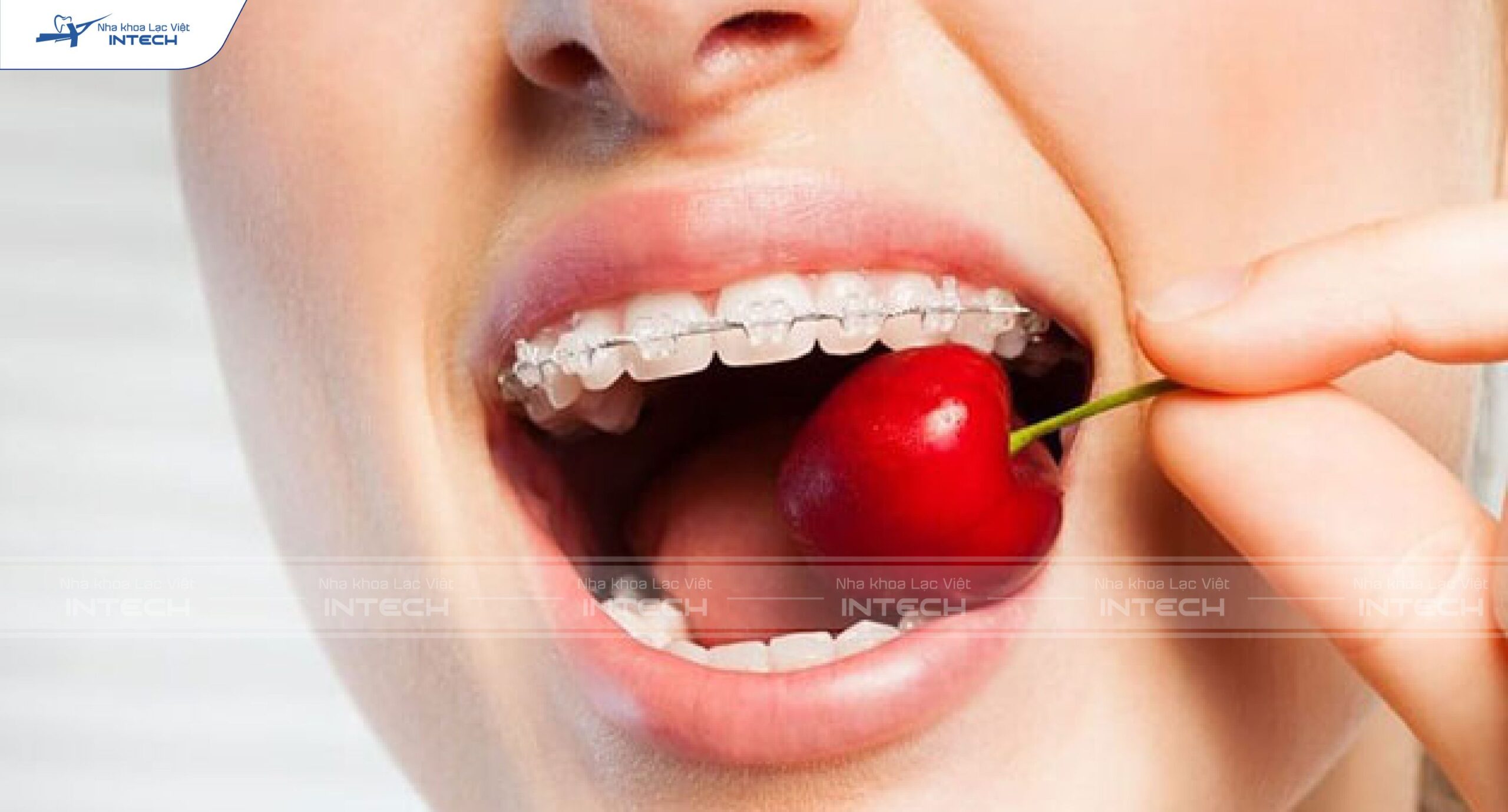 Thói quen ăn nhai không đúng cách dẫn đến răng gặp tình trạng gò má cao