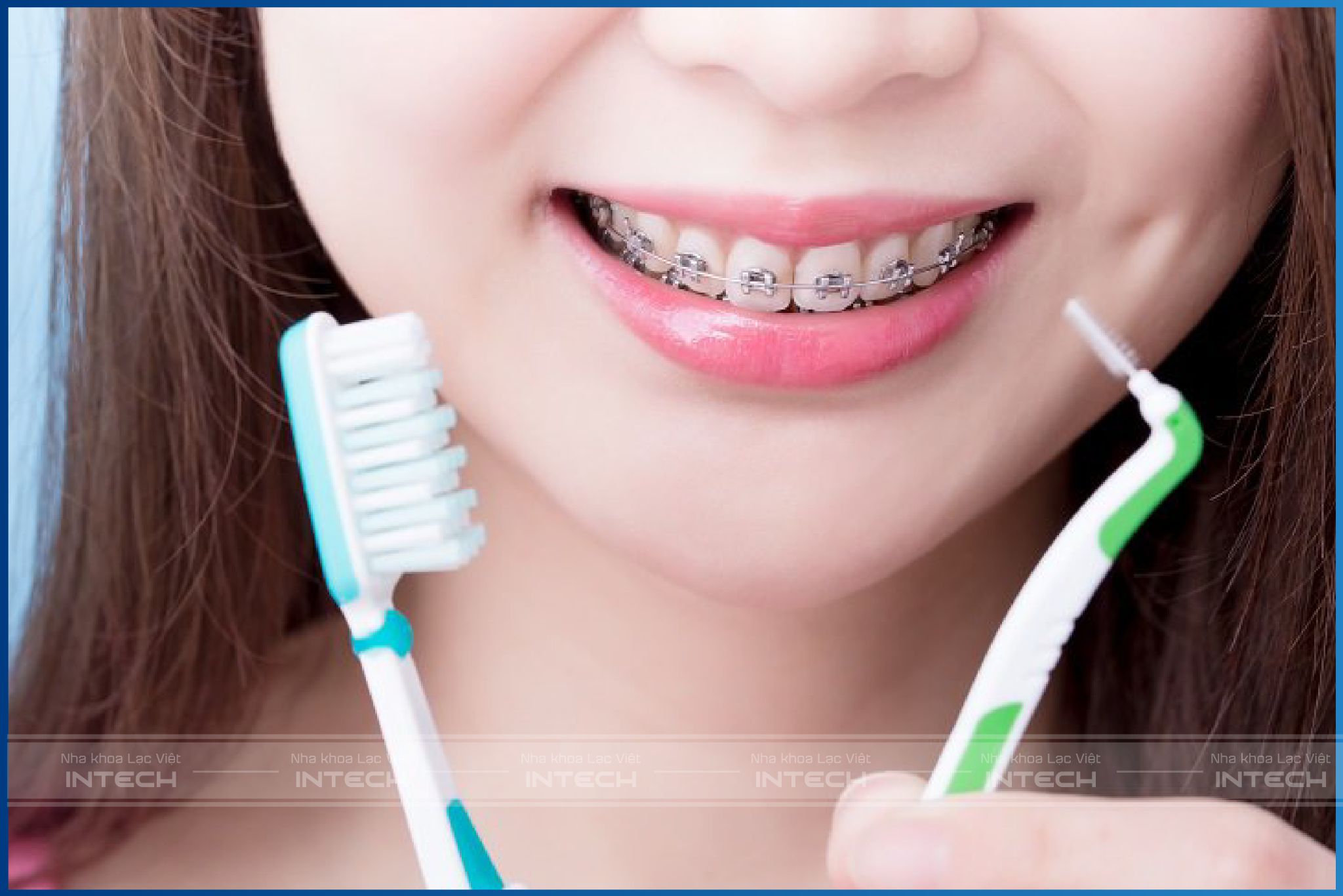 Vệ sinh răng miệng khi niềng giúp đảm bảo hiệu quả chỉnh nha Vệ sinh răng miệng khi niềng giúp đảm bảo hiệu quả chỉnh nha