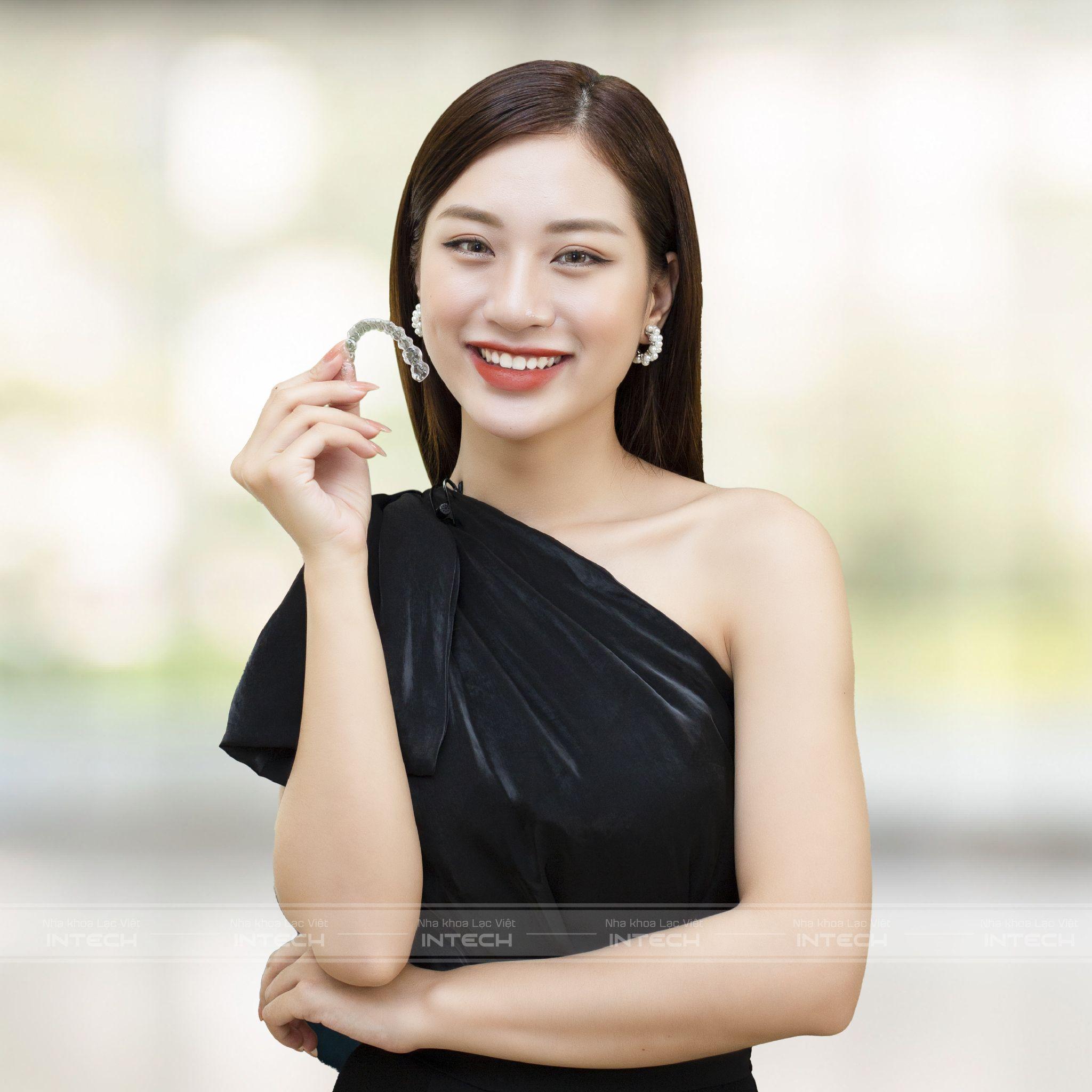 Niềng răng Invisalign trả góp giúp khách hàng nhẹ gánh chi phí 1 ca thanh cong nieng rang tra gop tai lac viet intech