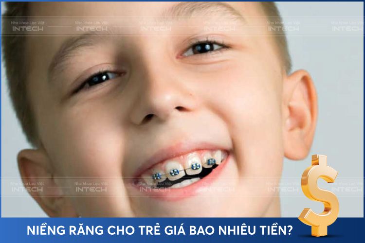 Niềng răng cho trẻ em giá bao nhiêu? Niềng răng cho trẻ em giá bao nhiêu?