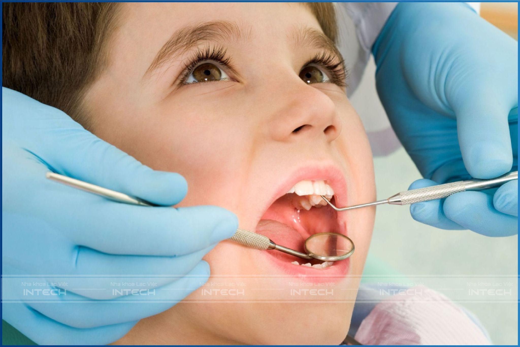Niềng răng cho trẻ cần đặc biệt chú trọng đến các khí cụ, vật liệu sử dụng
