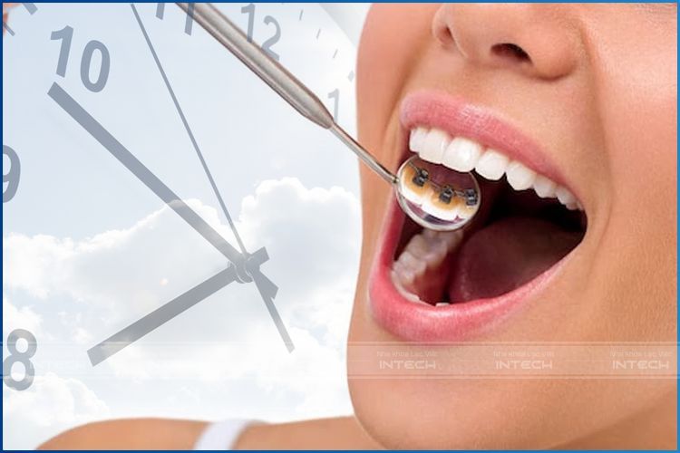 Niềng răng mặt trong đảm bảo thẩm mỹ cao. Niềng răng mặt trong đảm bảo thẩm mỹ cao.