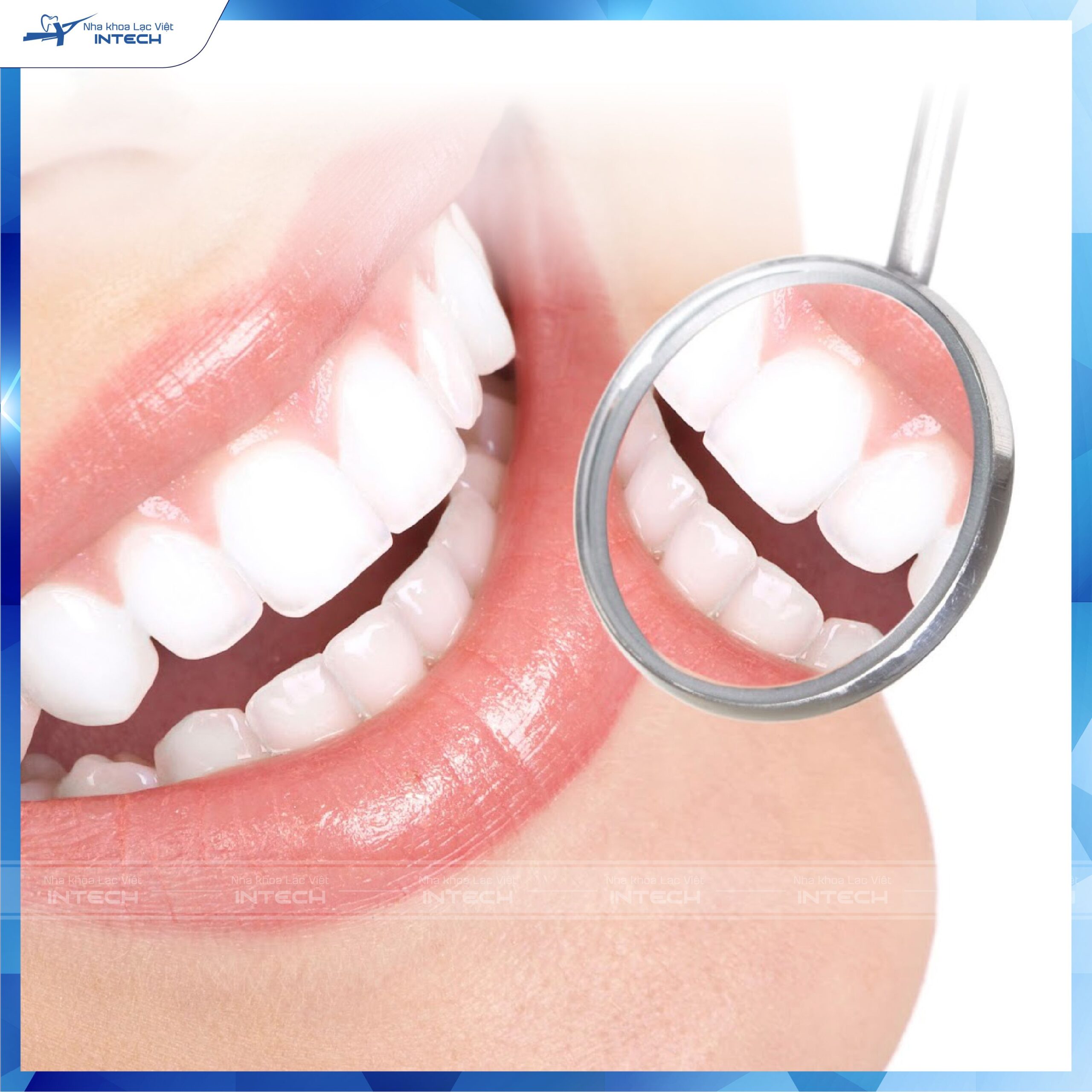 Răng sứ ngày càng được nhiều người ưa chuộng lựa chọn sử dụng