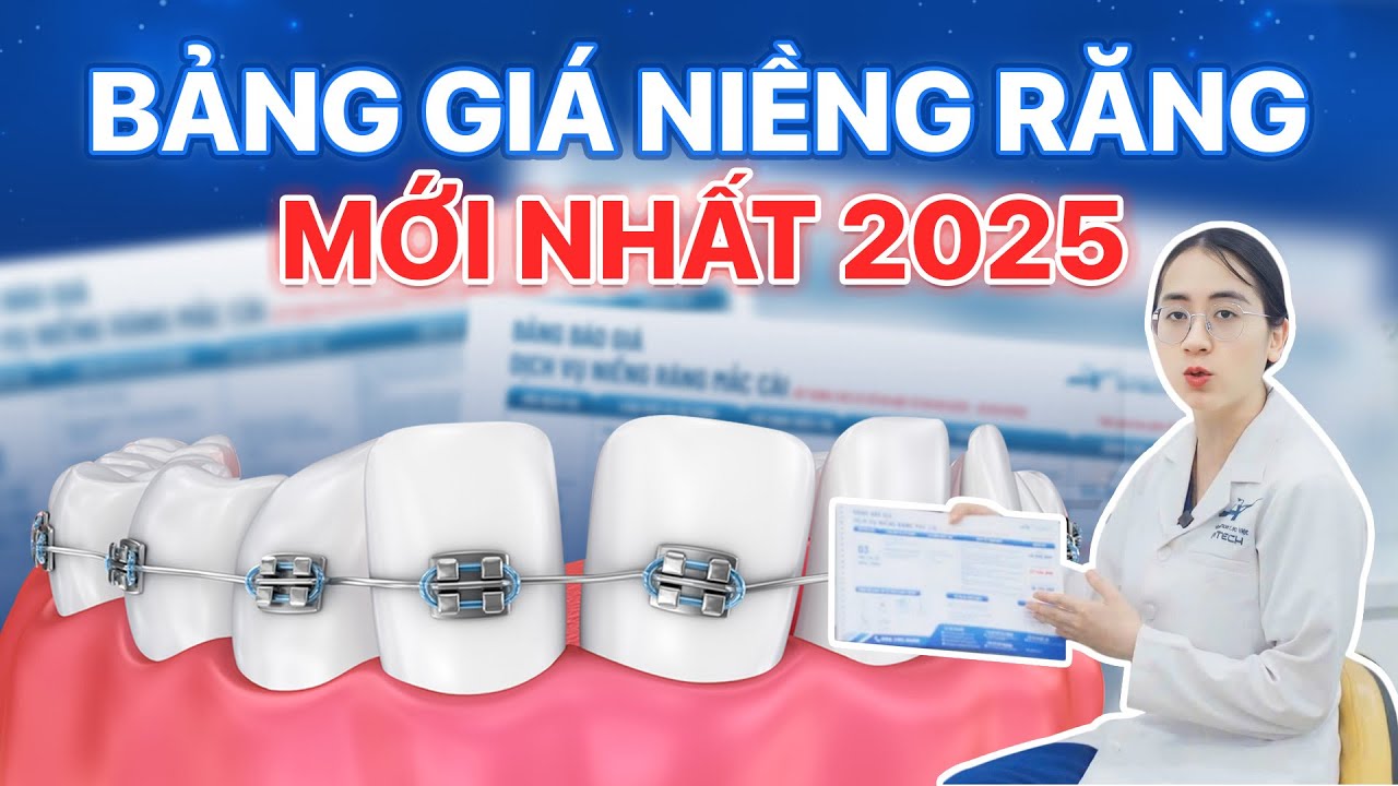 Giá niềng răng từng loại mắc cài bao nhiêu hiện nay mới nhất?