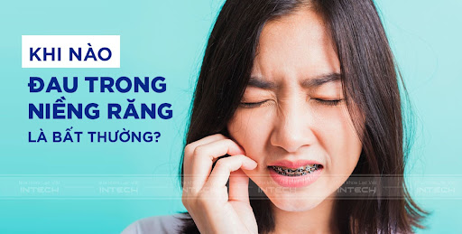Niềng răng có đau không? Cơ chế đau trong niềng răng 4 Nếu có những biểu hiện đau bất thường bạn cần liên hệ với nha sĩ để được hỗ trợ