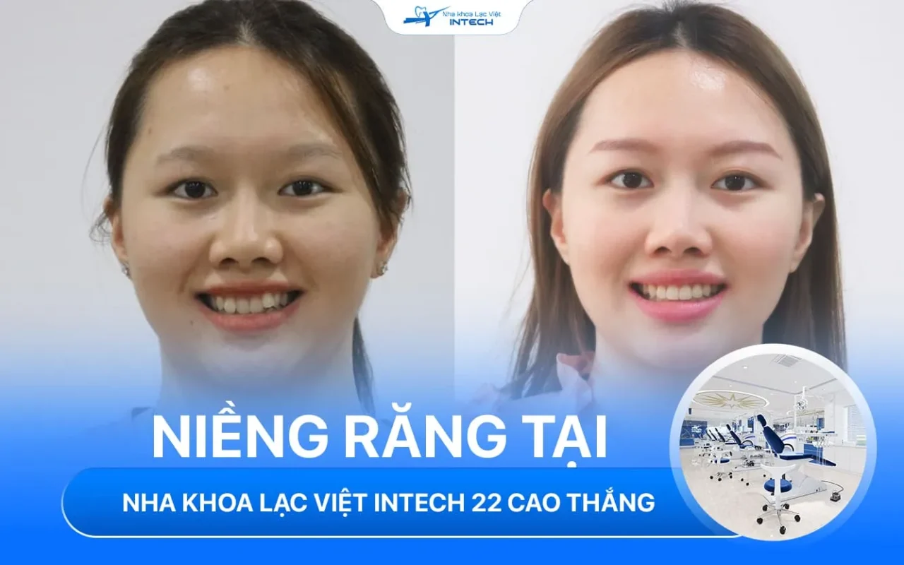 Nha khoa lac viet intech cao thang vinh nghe an 4