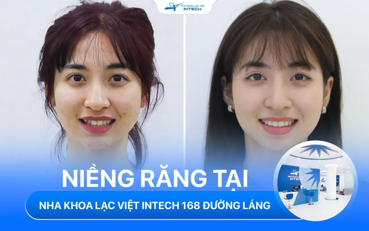 Nha khoa lac viet intech duong lang dong da ha noi 2