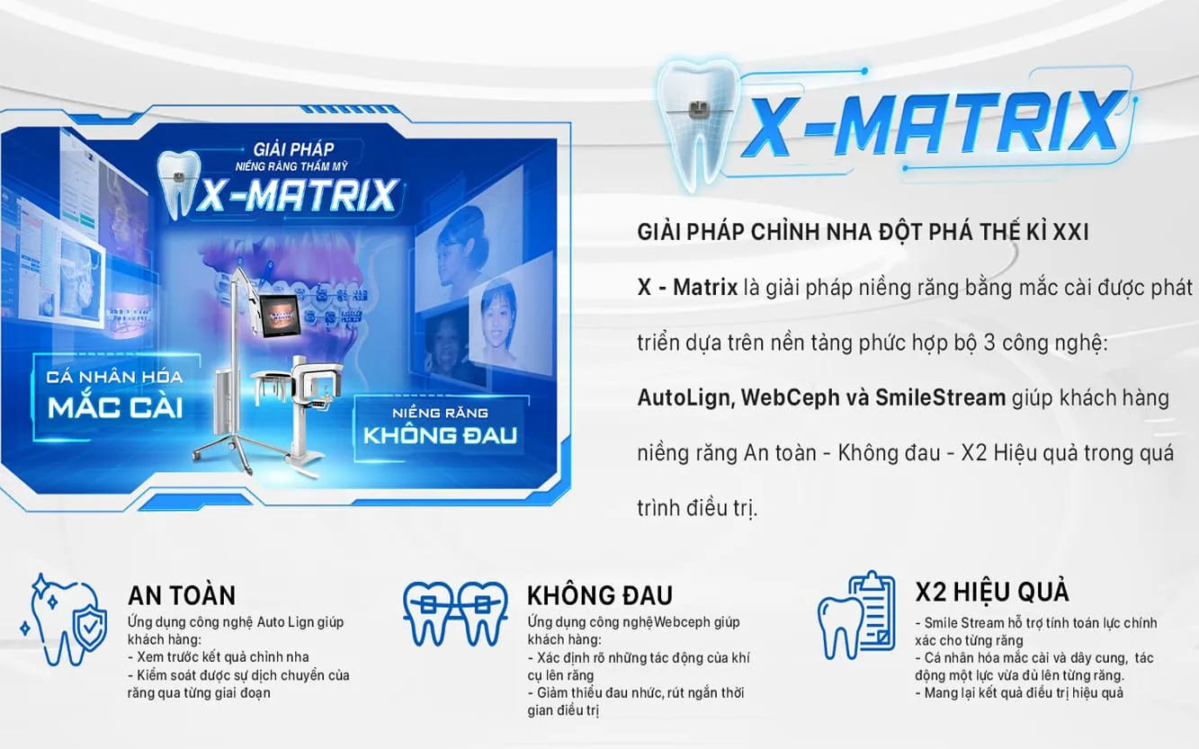 Nha Khoa Lạc Việt Intech | 91 Phố Huế - Hai Bà Trưng 14 Nha khoa lac viet intech - giai phap nieng rang x-matrix (2)