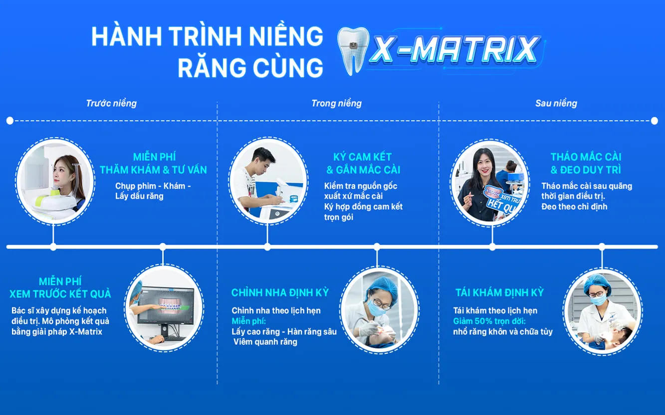 Nha Khoa Lạc Việt Intech | 91 Phố Huế - Hai Bà Trưng 15 Nha khoa lac viet intech - giai phap nieng rang x-matrix (3)