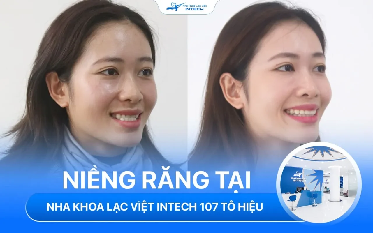 Nha khoa lac viet intech le chan hai phong 7