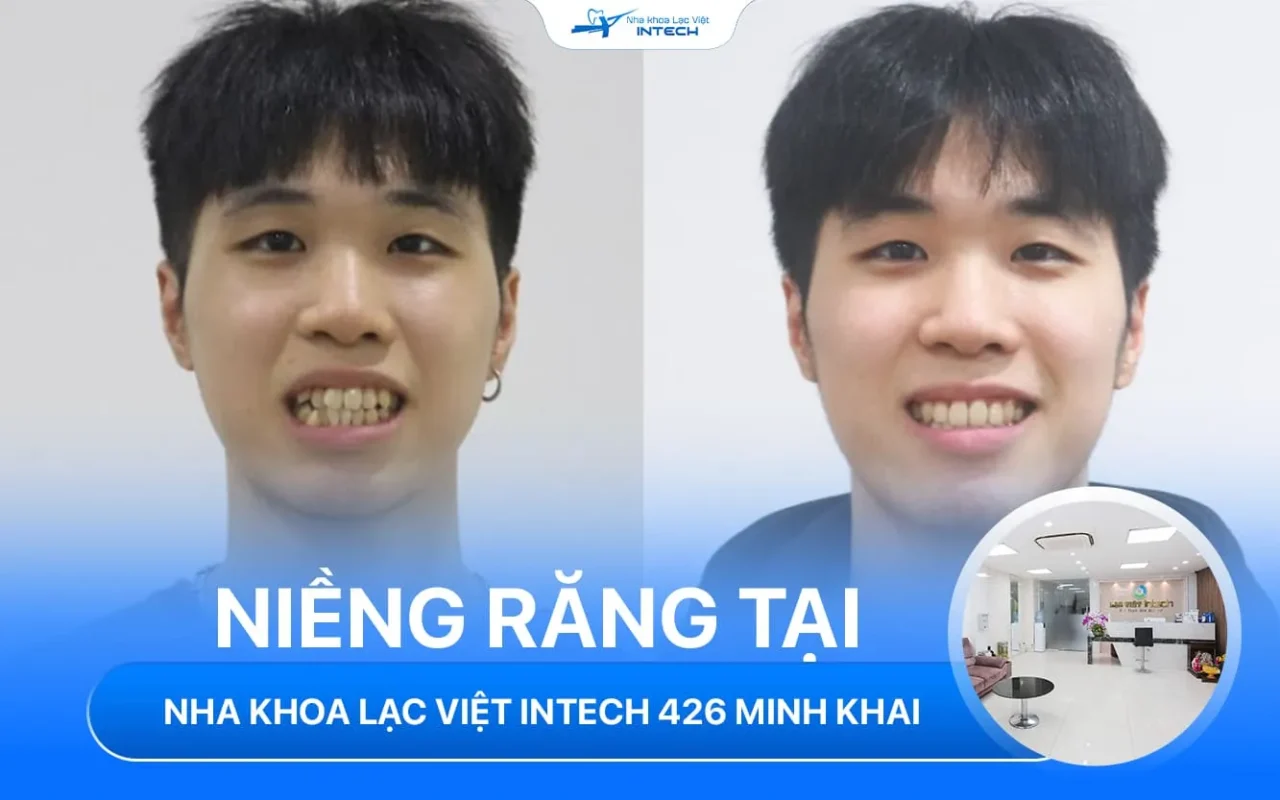 Nha khoa lac viet intech minh khai hai ba trung ha noi 2