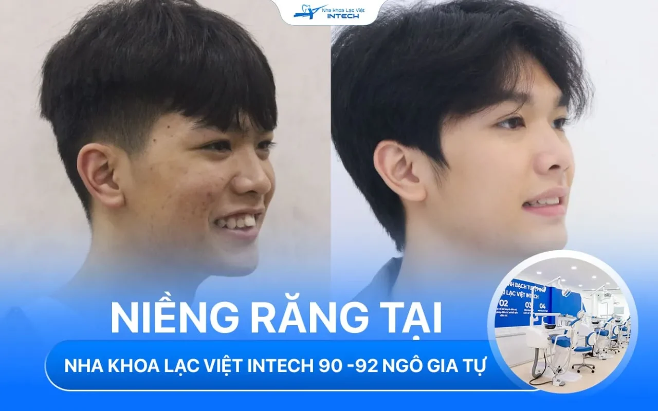 Nha khoa lac viet intech ngo gia tu quan 10 ho chi minh 12