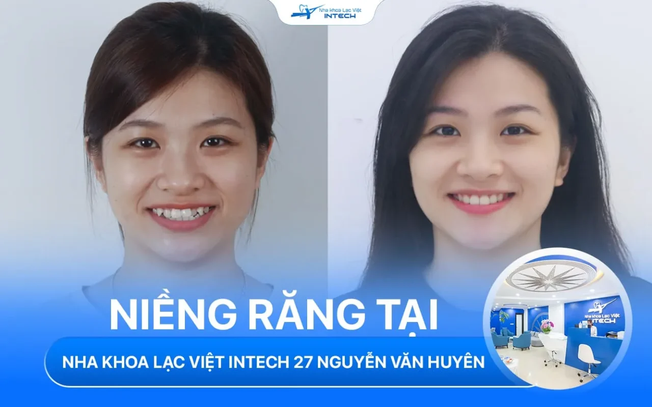 Nha khoa lac viet intech nguyen van huyen cau giay ha noi 2