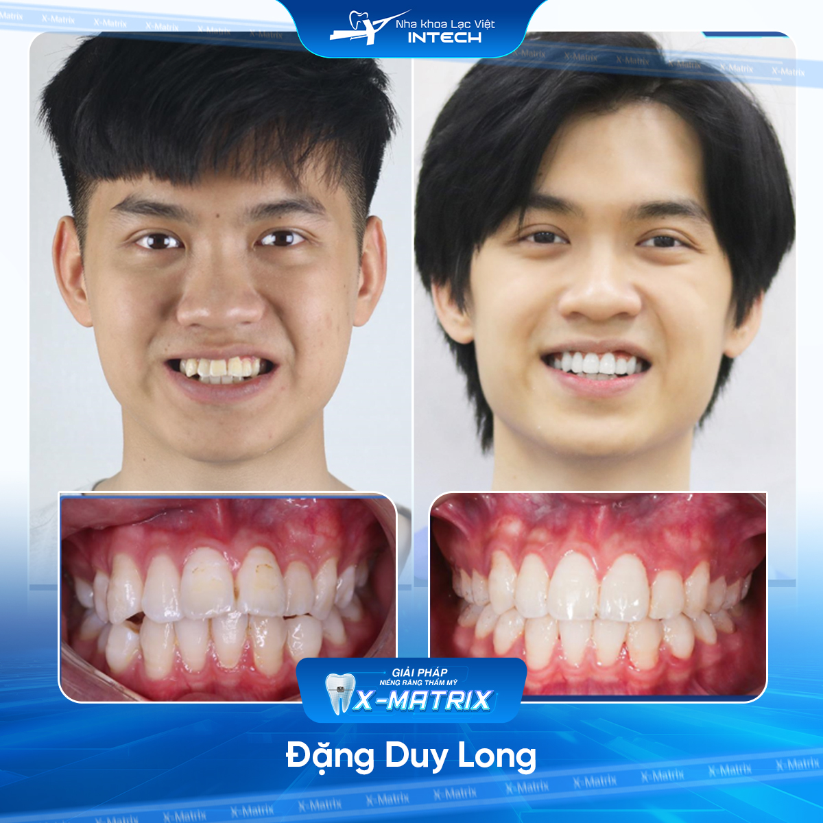 Bác sĩ niềng răng Cao Linh | Thông Tin - Đặt Lịch Bác Sĩ 11 Bac si nieng rang Cao Linh nha khoa Lac Viet Intech