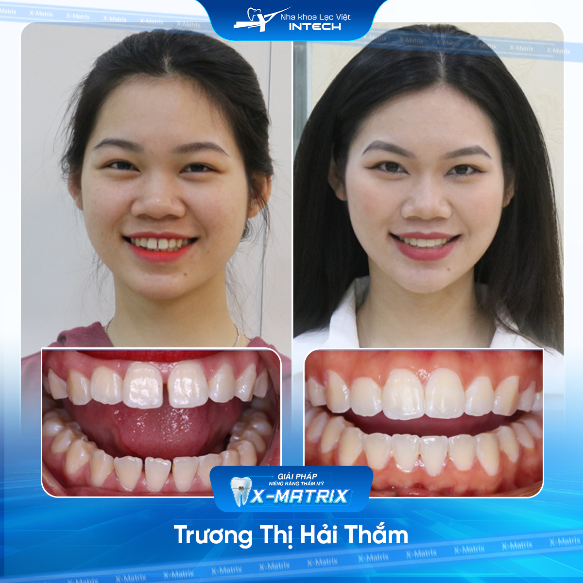 Bác sĩ niềng răng Cao Linh | Thông Tin - Đặt Lịch Bác Sĩ 10 Bac si nieng rang Cao Linh nha khoa Lac Viet Intech