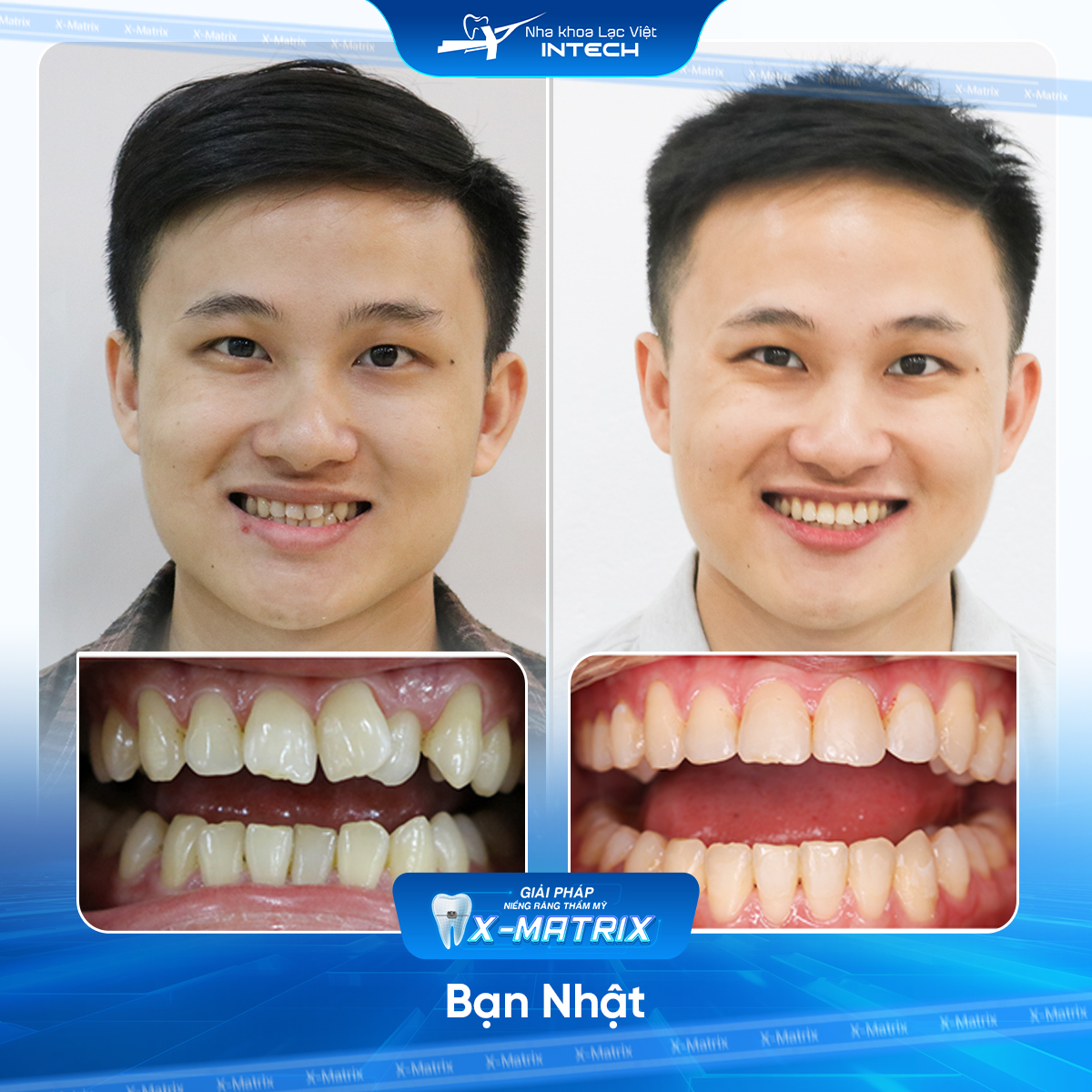 Bác sĩ niềng răng Cao Linh | Thông Tin - Đặt Lịch Bác Sĩ 18 Bac si nieng rang Cao Linh nha khoa Lac Viet Intech