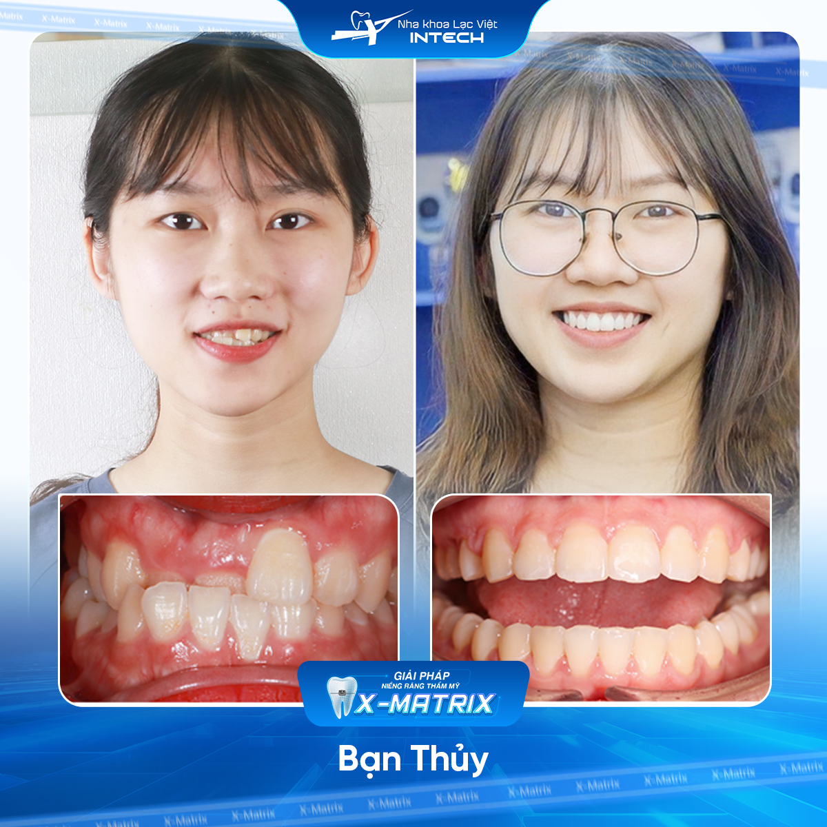 Bác sĩ niềng răng Cao Linh | Thông Tin - Đặt Lịch Bác Sĩ 17 Bac si nieng rang Cao Linh nha khoa Lac Viet Intech
