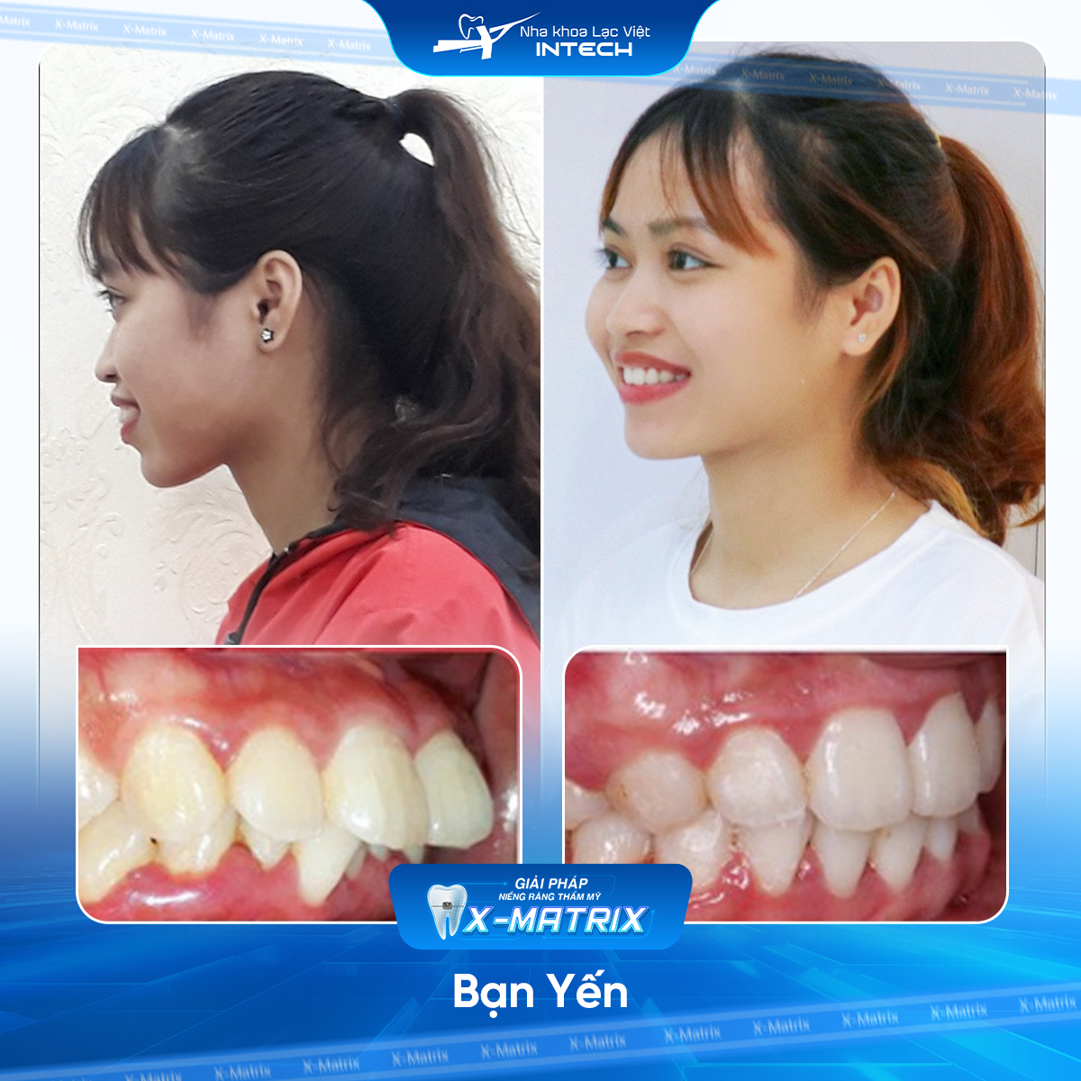 Bác sĩ niềng răng Cao Linh | Thông Tin - Đặt Lịch Bác Sĩ 16 Bac si nieng rang Cao Linh nha khoa Lac Viet Intech