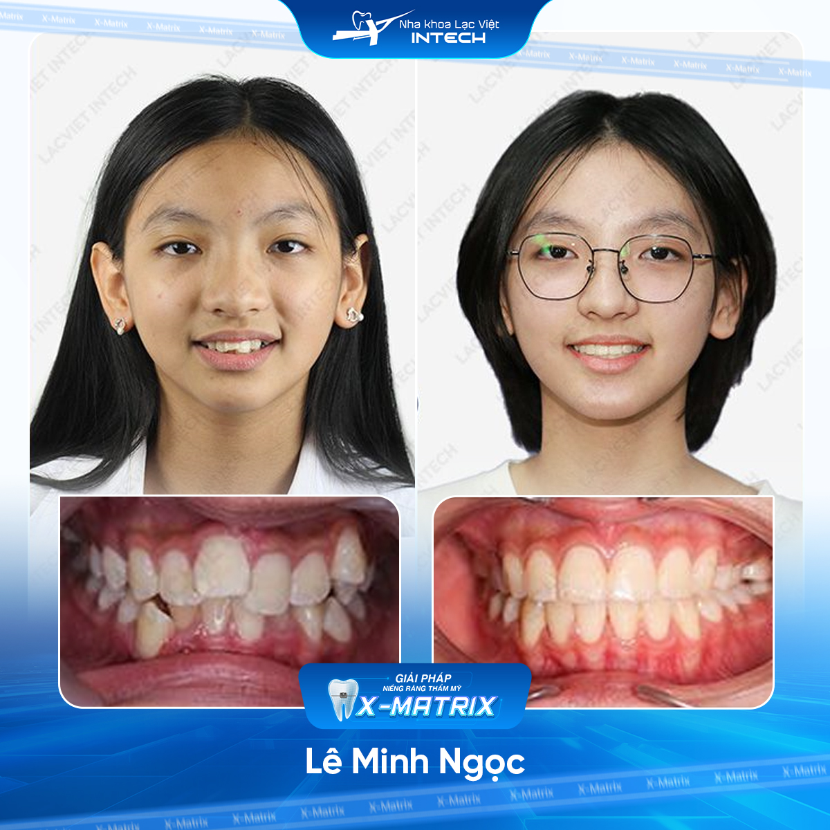 Bac si nieng rang Mai Anh nha khoa Lac Viet Intech