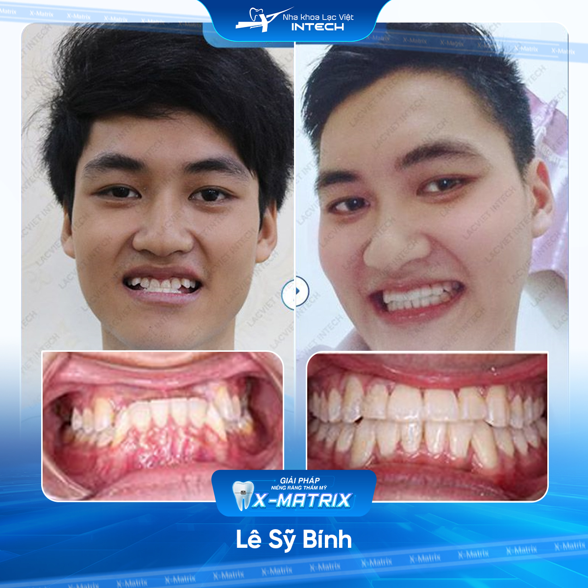 Bác sĩ niềng răng Thu Anh | Thông Tin - Đặt Lịch Bác Sĩ 13 Bac si nieng rang Thu Anh nha khoa Lac Viet Intech