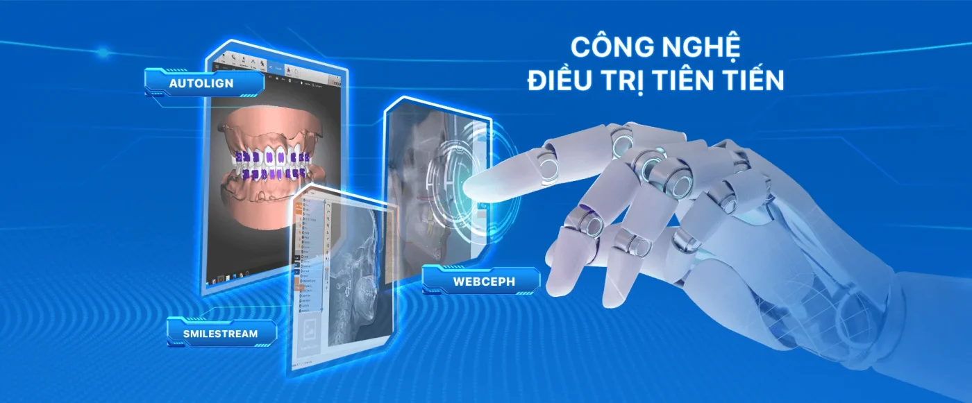 nieng rang lac viet intech nha khoa lac viet (8)