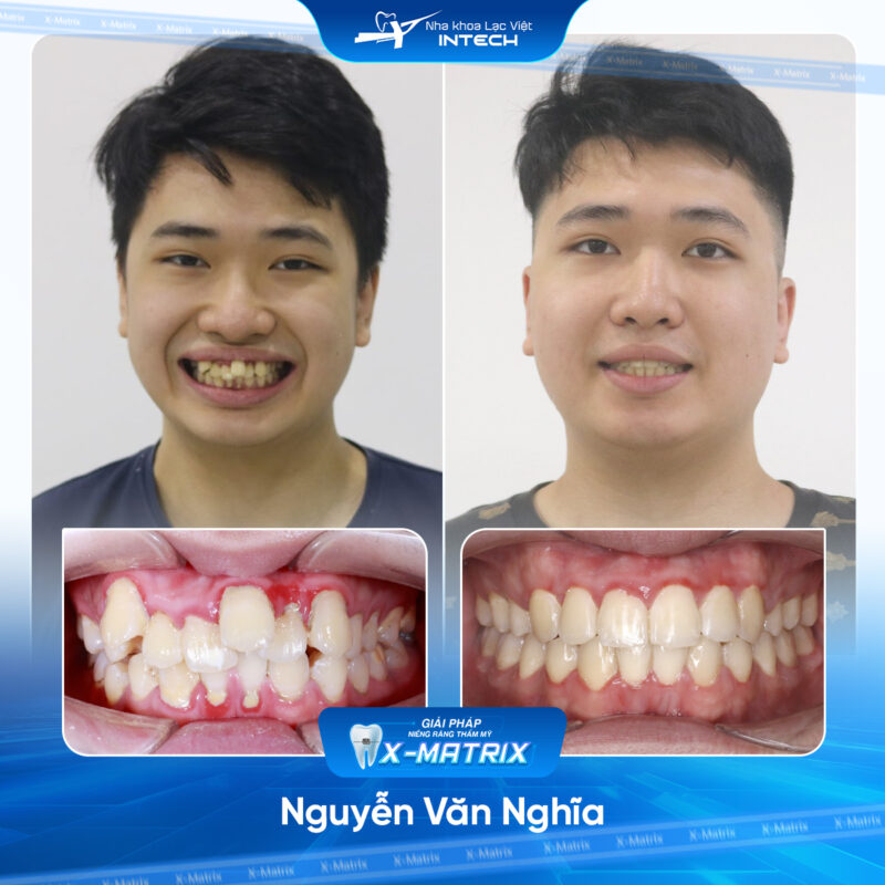 BA 2024 copy van nghia