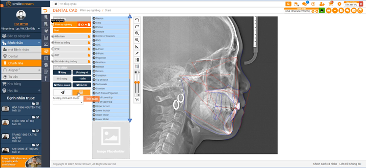 SmileStream – Công nghệ kiểm soát lực niềng và tối ưu nụ cười thẩm mỹ trong giải pháp X-Matrix 1 cong nghe SmileStream x matrix nha khoa lac viet intech 3