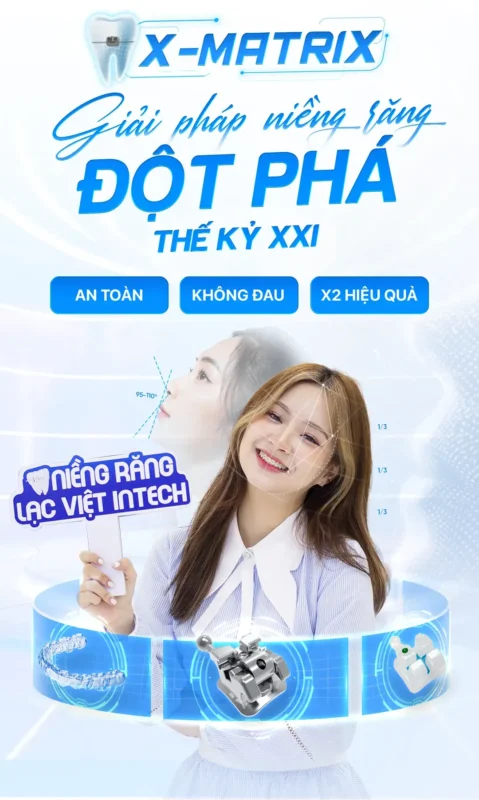 Nieng rang nha khoa lac viet intech mobile 1