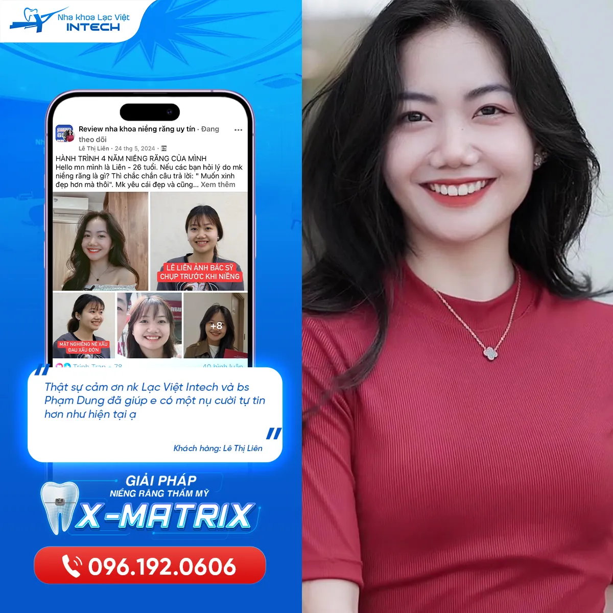 feedback t2 lien_nhakhoalacvietintec_niengrang