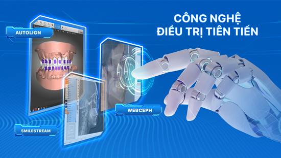 cong nghe Webceph – x-matrix – nha khoa lac viet intech (1) cong nghe Webceph - x-matrix - nha khoa lac viet intech (1)